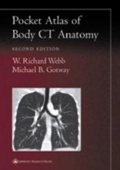 Image of Pocket Atlas of Body Ct Anatomy by W. Richard Webb Paperback