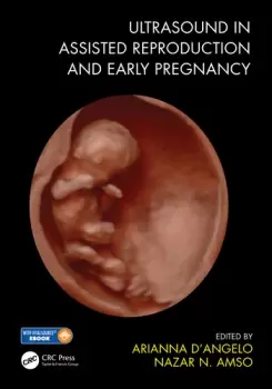 Image of Ultrasound in Assisted Reproduction and Early Pregnancy