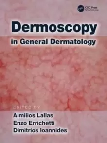 Image of Dermoscopy in General Dermatology
