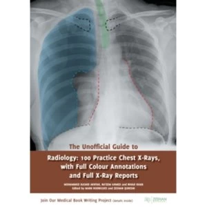 image of The Unofficial Guide to Radiology : 100 Practice Chest X-Rays