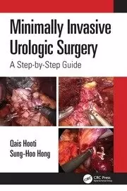 Image of Minimally Invasive Urologic Surgery A Step-by-Step Guide