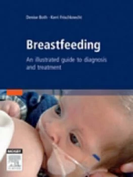 Image of Breastfeeding by Denise Both Hardback