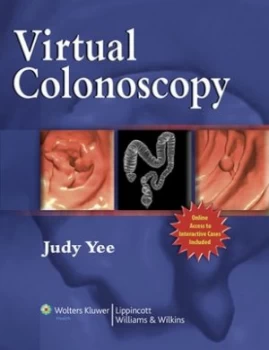 Image of Virtual Colonoscopy by Judy Yee Hardback
