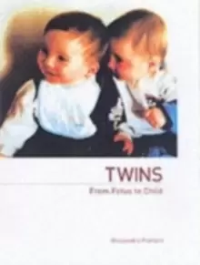 Image of Twins - From Fetus to Child