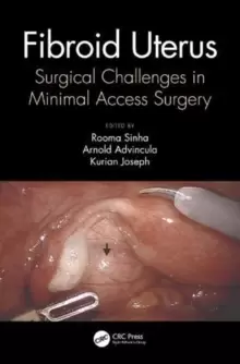 Image of Fibroid Uterus : Surgical Challenges in Minimal Access Surgery
