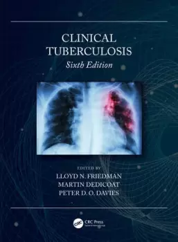 Image of Clinical Tuberculosis