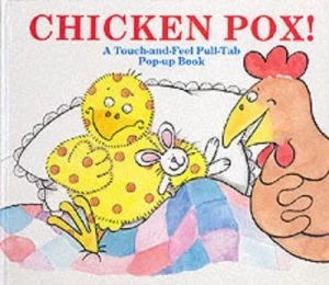 Image of Chicken Pox by Shen Roddie and Frances Cony Book