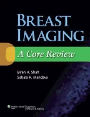Image of breast imaging a core review