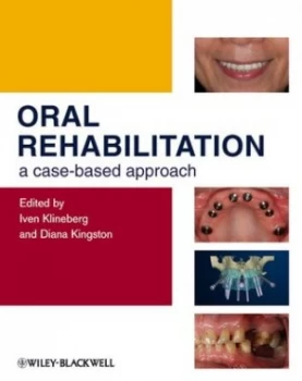 Image of Oral Rehabilitation by Iven Klineberg Hardback