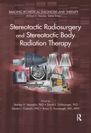 Image of Stereotactic Radiosurgery and Stereotactic Body Radiation Therapy