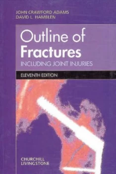 Image of Outline of Fractures Including Joint Injuries by John Crawford Adams Paperback