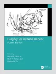 Image of Surgery for Ovarian Cancer