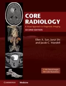 Image of Core Radiology : A Visual Approach to Diagnostic Imaging