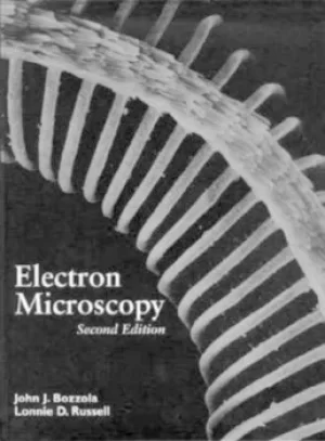 Image of Electron microscopy by John J Bozzola