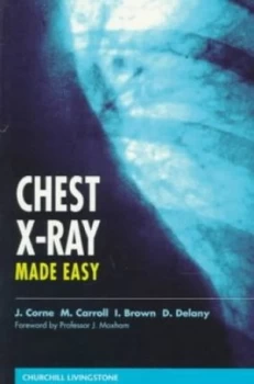 Image of Chest X-Ray Made Easy by Jonathan Corne Paperback