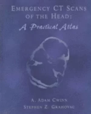 Image of emergency ct scans of the head a practical atlas