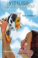 Image of vitiligo doesnt scare me