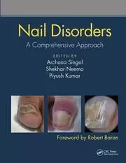 Image of Nail Disorders A Comprehensive Approach
