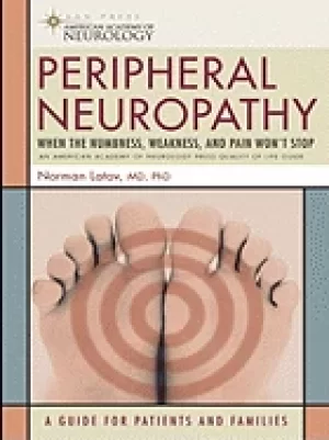 Image of peripheral neuropathy when the numbness weakness and pain wont stop