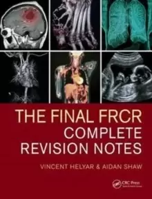 Image of The Final FRCR : Complete Revision Notes