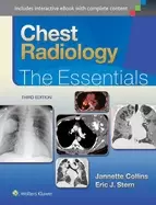 Image of chest radiology the essentials