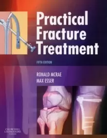 Image of Practical Fracture Treatment