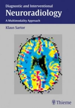 Image of Neuroradiology by Klaus Sartor Hardback