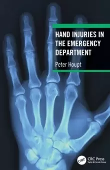 Image of Hand Injuries in the Emergency Department