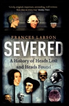 Image of Severed by Frances Larson Book