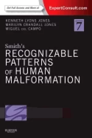 Image of smiths recognizable patterns of human malformation expert consult online an