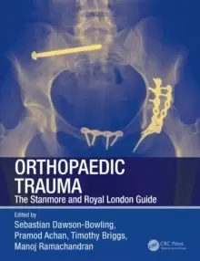 Image of Orthopaedic Trauma : The Stanmore and Royal London Guide