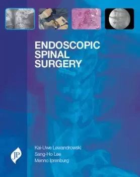 Image of Endoscopic Spinal Surgery