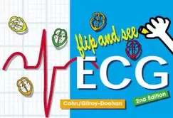 Image of flip and see ecg