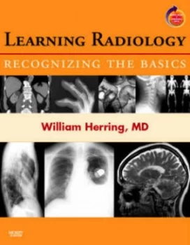 Image of Learning Radiology by William Herring Paperback