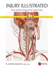 Image of Injury Illustrated : How Medical Images Win Legal Cases