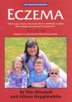 Image of Eczema by Tim Mitchell and Alison Hepplewhite Book