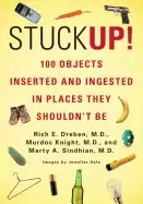 Image of stuck up 100 objects inserted and ingested in places they shouldnt be
