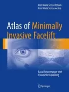 Image of atlas of minimally invasive facelift facial rejuvenation with volumetric li