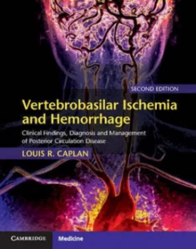 Image of Vertebrobasilar Ischemia and Hemorrhage by Louis R. Caplan Hardback