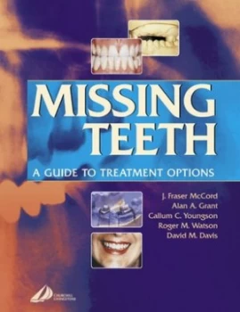 Image of Missing Teeth by J. Fraser Mccord Paperback