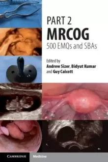 Image of Part 2 MRCOG: 500 EMQs and SBAs