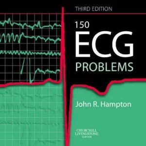 Image of 150 Ecg Problems by John R Hampton Paperback
