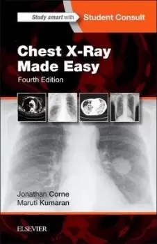 Image of Chest X-Ray Made Easy by Jonathan Corne