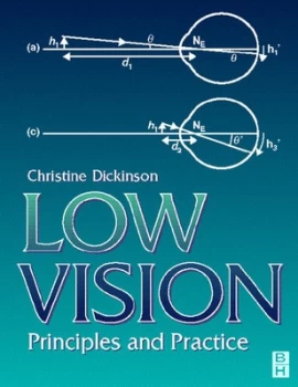 Image of Low Vision by Christine Dickinson Paperback
