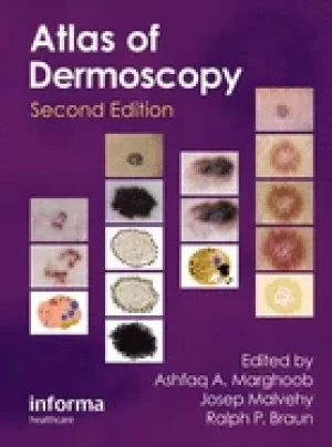 Image of exatlas of dermoscopy