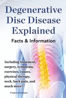 Image of Degenerative Disc Disease Explained. Including treatment, surgery, symptoms, exercises, causes, physical therapy, neck, back, pain, and much more! Fac
