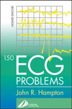 Image of 150 Ecg Problems by David Adlam Paperback