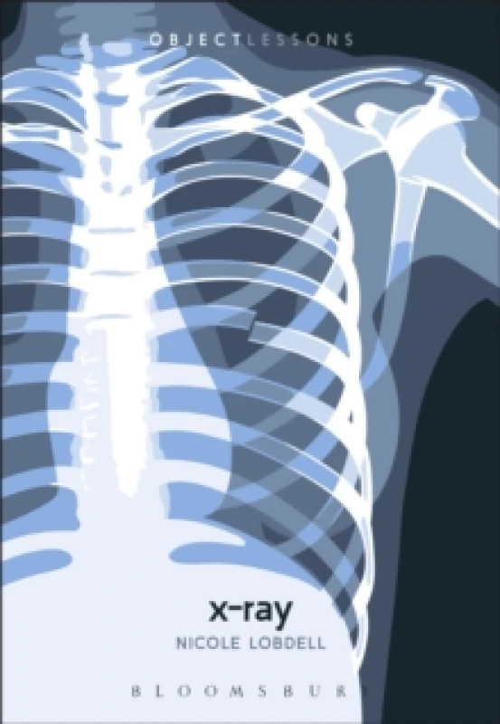 Image of x ray 9781501386701