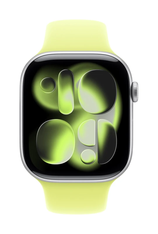 Image of Apple 46mm Neon Yellow Sport Band - S/M MFGV4ZM/A