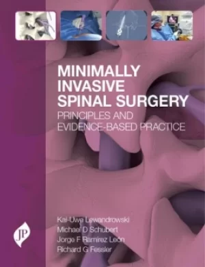 Image of Minimally Invasive Spinal SurgeryPrinciples and Evidence-Based Practice